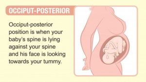 breech presentation and longitudinal lie